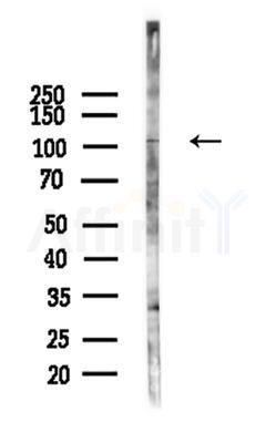 ZNF387 Antibody - Western blot analysis of lysates from A375 cells(heat-shock,45min treatment), using ZNF387 Antibody at 1/1000 dilution.