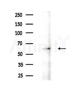 DKC1 Antibody - Western blot analysis of extracts from B16F10-LUC cells(starvation treatment), using DKC1 Antibody at 1/1000 dilution.