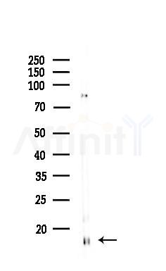 PFDN1 Antibody - Western blot analysis of lysates from 3T3-L1 P6(LPS, 4h treatment), using PFDN1 Antibody at 1/1000 dilution.