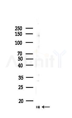 PFDN1 Antibody - Western blot analysis of lysates from K562 cells(heat-shock,45min treatment), using PFDN1 Antibody at 1/1000 dilution.