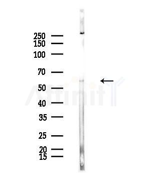 LAT3 Antibody - Western blot analysis of lysates from Rat brain, using LAT3 Antibody at 1/1000 dilution.