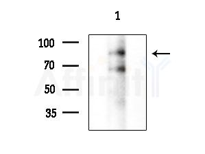 TACC1 Antibody - Western blot analysis of extracts from Mouse brain, using TACC1 Antibody at 1/1000 dilution.