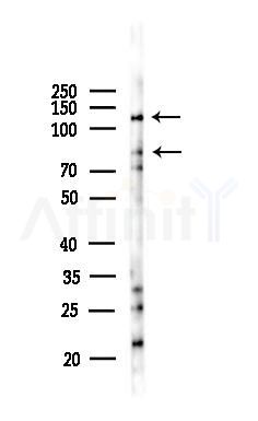 TACC1 Antibody - Western blot analysis of lysates from Mouse brain, using TACC1 Antibody at 1/1000 dilution.