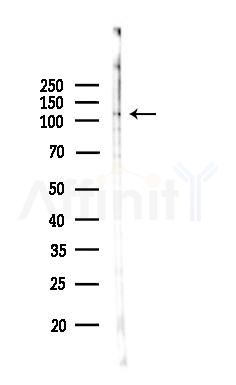 MED24 Antibody - Western blot analysis of lysates from 3T3-L1 P6(LPS, 4h treatment), using MED24 Antibody at 1/1000 dilution.