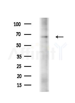 TAF5L Antibody - Western blot analysis of extracts from Raji cells(heat-shock,45min treatment), using TAF5L Antibody at 1/1000 dilution.