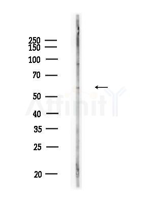 TAF5L Antibody - Western blot analysis of lysates from Raji cells(heat-shock,45min treatment), using TAF5L Antibody at 1/1000 dilution.