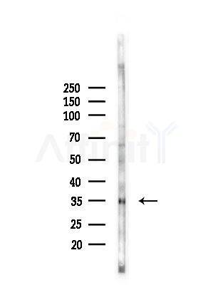 Renin receptor Antibody - Western blot analysis of lysates from PC12 cells(LPS, 4h treatment), using Renin receptor Antibody at 1/1000 dilution.