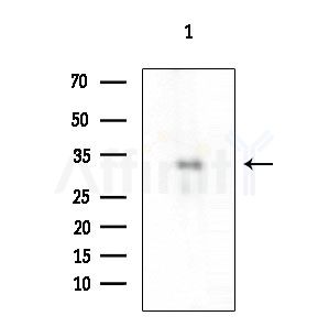 ALX3 Antibody - Western blot analysis of extracts from COLO205 cells, using ALX3 Antibody at 1/1000 dilution.