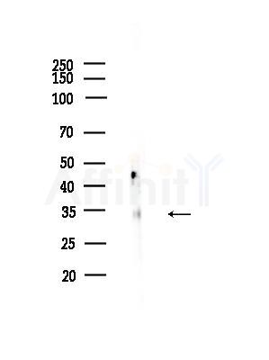 ALX3 Antibody - Western blot analysis of lysates from COLO205 cells, using ALX3 Antibody at 1/1000 dilution.