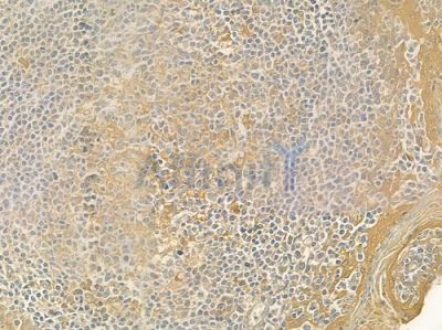 LRAT Antibody - DF3055 at 1/100 staining human normal tonsil tissue by IHC-P.