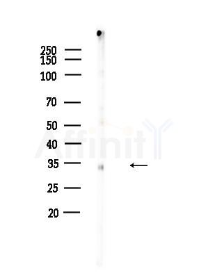 LRAT Antibody - Western blot analysis of lysates from EC304 cells, using LRAT Antibody at 1/1000 dilution.