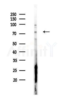 MYST2 Antibody - Western blot analysis of lysates from RAW264.