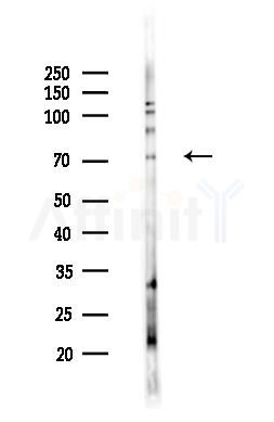 MYST2 Antibody - Western blot analysis of lysates from B16F10-LUC cells(heat-shock,45min treatment), using MYST2 Antibody at 1/1000 dilution.