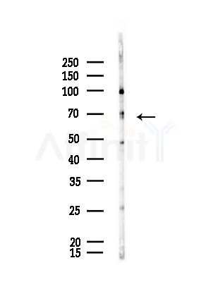 MED26 Antibody - Western blot analysis of lysates from Rat brain, using MED26 Antibody at 1/1000 dilution.