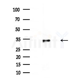 CBX6 Antibody - Western blot analysis of extracts from EC304 cells(starvation treatment), using CBX6 Antibody at 1/1000 dilution.