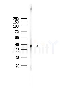 CBX6 Antibody - Western blot analysis of lysates from EC304 cells(starvation,24h treatment), using CBX6 Antibody at 1/1000 dilution.