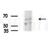 ZNF682 Antibody - Western blot analysis of extracts from HepG2 cells(UV treatment), using ZNF682 Antibody at 1/1000 dilution.