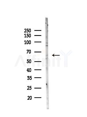 ZNF682 Antibody - Western blot analysis of lysates from HepG2 cells(UV,30min treatment), using ZNF682 Antibody at 1/1000 dilution.