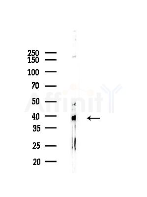 ALDOA Antibody - Western blot analysis of lysates from COLO205 cells(heat-shock,45min treatment), using ALDOA Antibody at 1/1000 dilution.