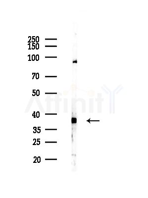 ALDOA Antibody - Western blot analysis of lysates from Hela cells(LPS, 4h treatment), using ALDOA Antibody at 1/1000 dilution.