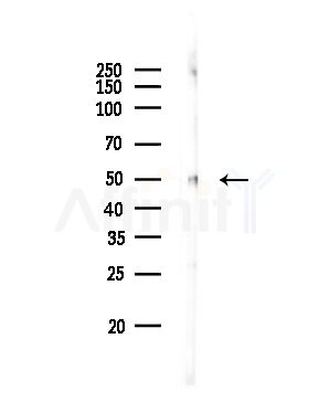HEXB Antibody - Western blot analysis of lysates from Rat brain, using HEXB Antibody at 1/1000 dilution.