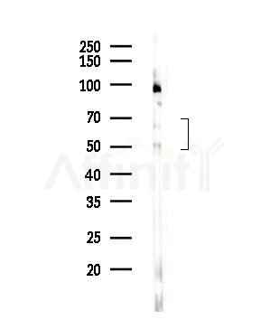 HEXB Antibody - Western blot analysis of lysates from COLO205 cells(UV,30min treatment), using HEXB Antibody at 1/1000 dilution.