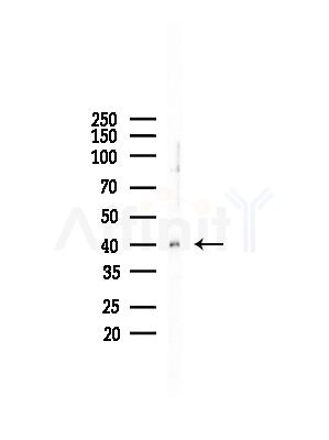 TACD2 Antibody - Western blot analysis of lysates from LoVo cells(heat-shock,45min treatment), using TACD2 Antibody at 1/1000 dilution.