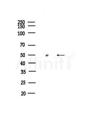 HARS Antibody - Western blot analysis of lysates from Rat testis, using HARS Antibody at 1/1000 dilution.