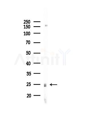 MYF5 Antibody - Western blot analysis of lysates from Hela cells(starvation,24h treatment), using MYF5 Antibody at 1/1000 dilution.