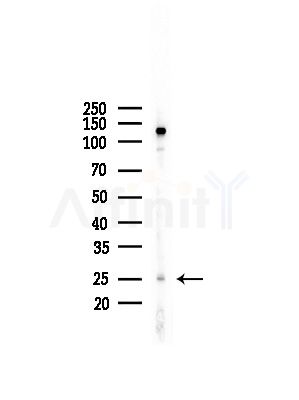 MYF5 Antibody - Western blot analysis of lysates from LoVo cells(heat-shock,45min treatment), using MYF5 Antibody at 1/1000 dilution.