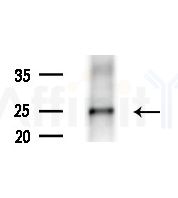 TCTP Antibody - Western blot analysis of extracts from HepG2 cells(UV treatment), using TCTP Antibody at 1/1000 dilution.