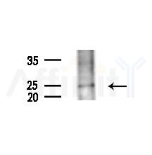 TCTP Antibody - Western blot analysis of extracts from Mouse testis, using TCTP Antibody at 1/1000 dilution.