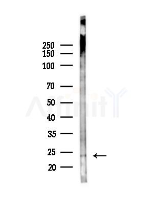 TCTP Antibody - Western blot analysis of lysates from Mouse testis, using TCTP Antibody at 1/1000 dilution.
