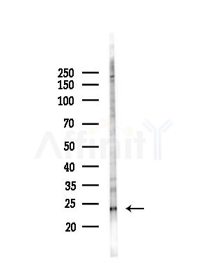 TCTP Antibody - Western blot analysis of lysates from HepG2 cells(UV,30min treatment), using TCTP Antibody at 1/1000 dilution.