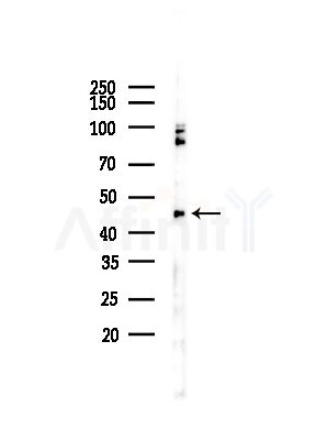 PKA R2 Antibody - Western blot analysis of lysates from COLO205 cells(UV,30min treatment), using PKA R2 Antibody at 1/1000 dilution.