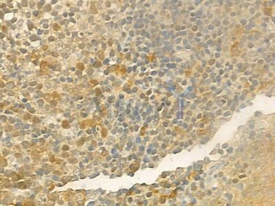 IRF2 Antibody - DF3093 at 1/100 staining human normal tonsil tissue by IHC-P.