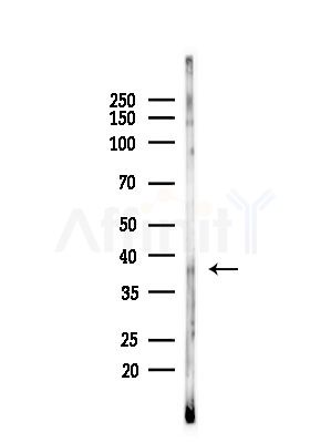 FRA1 Antibody - Western blot analysis of lysates from LoVo cells(heat-shock,45min treatment), using FRA1 Antibody at 1/1000 dilution.