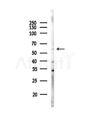 ZNF18 Antibody - Western blot analysis of lysates from A375 cells(LPS, 4h treatment), using ZNF18 Antibody at 1/1000 dilution.
