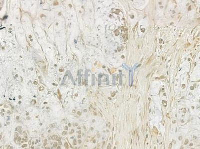 UBF1 Antibody - DF3102 at 1/100 staining human normal liver tissue by IHC-P.