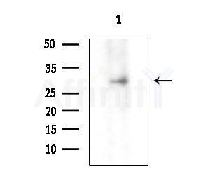 HOXB9 Antibody - Western blot analysis of extracts from 3T3-L1 cells(LPS  4h treatment), using HOXB9 Antibody at 1/1000 dilution.