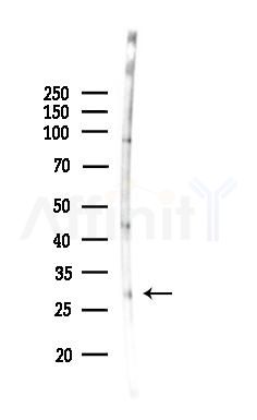 HOXB9 Antibody - Western blot analysis of lysates from 3T3-L1 P6(LPS, 4h treatment), using HOXB9 Antibody at 1/1000 dilution.