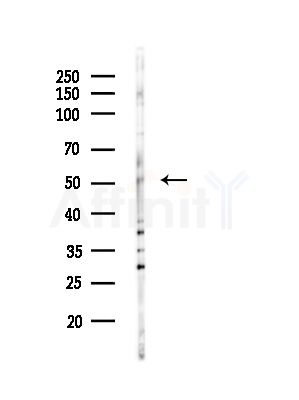 ATF7 Antibody - Western blot analysis of lysates from A375 cells(LPS, 4h treatment), using ATF7 Antibody at 1/1000 dilution.