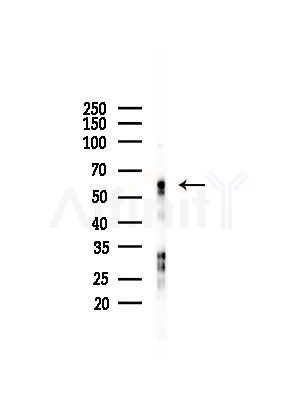 Adrenergic Receptor  alpha -2C Antibody - Western blot analysis of lysates from LoVo cells(heat-shock,45min treatment), using Adrenergic Receptor  alpha -2C Antibody at 1/1000 dilution.