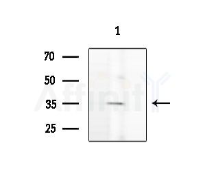 TSPAN8 Antibody - Western blot analysis of extracts from HUVEC cells, using TSPAN8 Antibody at 1/1000 dilution.