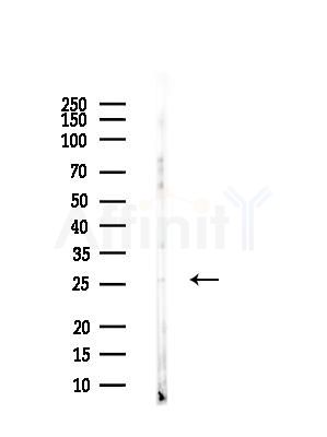 TSPAN8 Antibody - Western blot analysis of lysates from HUVEC cells, using TSPAN8 Antibody at 1/1000 dilution.