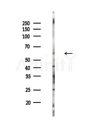 TFEB Antibody - Western blot analysis of lysates from EC304 cells(heat-shock treatment), using TFEB Antibody at 1/1000 dilution.