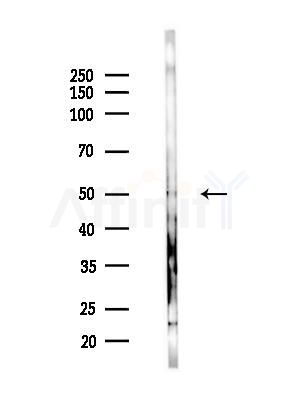 TFEB Antibody - Western blot analysis of lysates from B16F10-LUC cells(LPS,4h treatment), using TFEB Antibody at 1/1000 dilution.