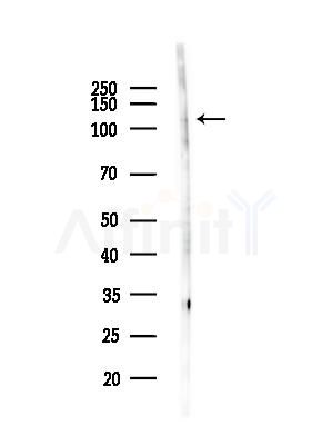 EPHA1 Antibody - Western blot analysis of lysates from LoVo cells(heat-shock,45min treatment), using EPHA1 Antibody at 1/1000 dilution.