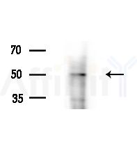 PKA beta Antibody - Western blot analysis of extracts from MCF7 cells(heat-shock,45min treatment), using PKA beta Antibody at 1/1000 dilution.