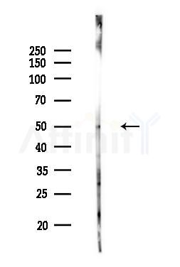 PKA beta Antibody - Western blot analysis of lysates from MCF7 cells(heat-shock,45min treatment), using PKA beta Antibody at 1/1000 dilution.